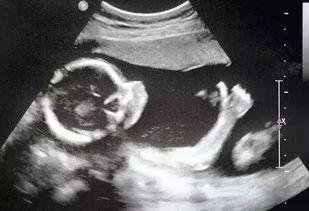 网友爆料医院b超室视频,网友曝光真实工作场景